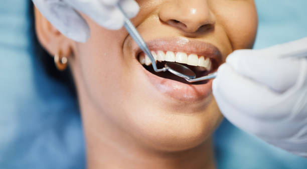 Best Emergency Dental Care for Broken or Chipped Teeth in Del Monte Forest, CA
