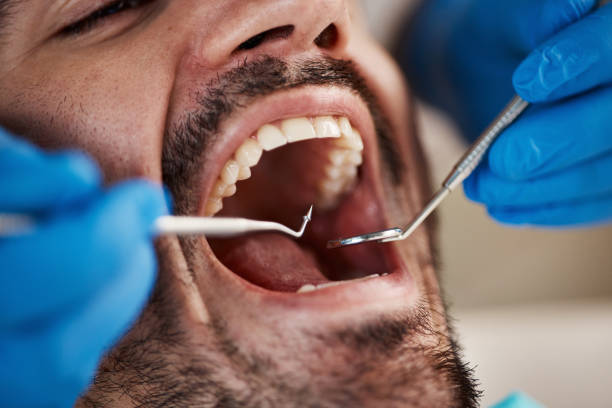 Best Emergency Dental Care for Broken or Chipped Teeth in Del Monte Forest, CA