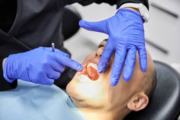 Best Emergency Gum Treatment in Del Monte Forest, CA